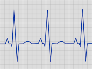 HeartBeat